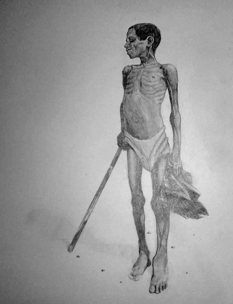 A anatomy study created from a starving African child found in an ad. Hand drawn with pencil